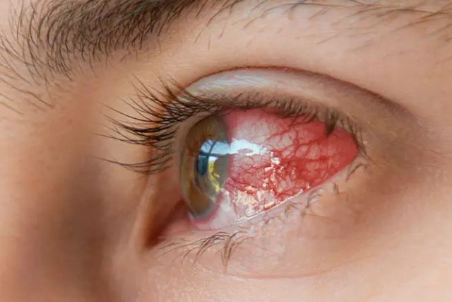 Eye Emergencies a Cedar Park, Texas